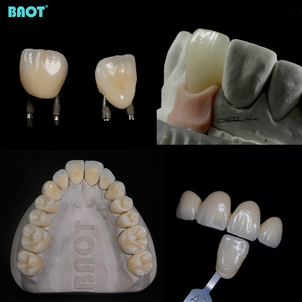 Four dentaire pour utilisation en laboratoire dentaire