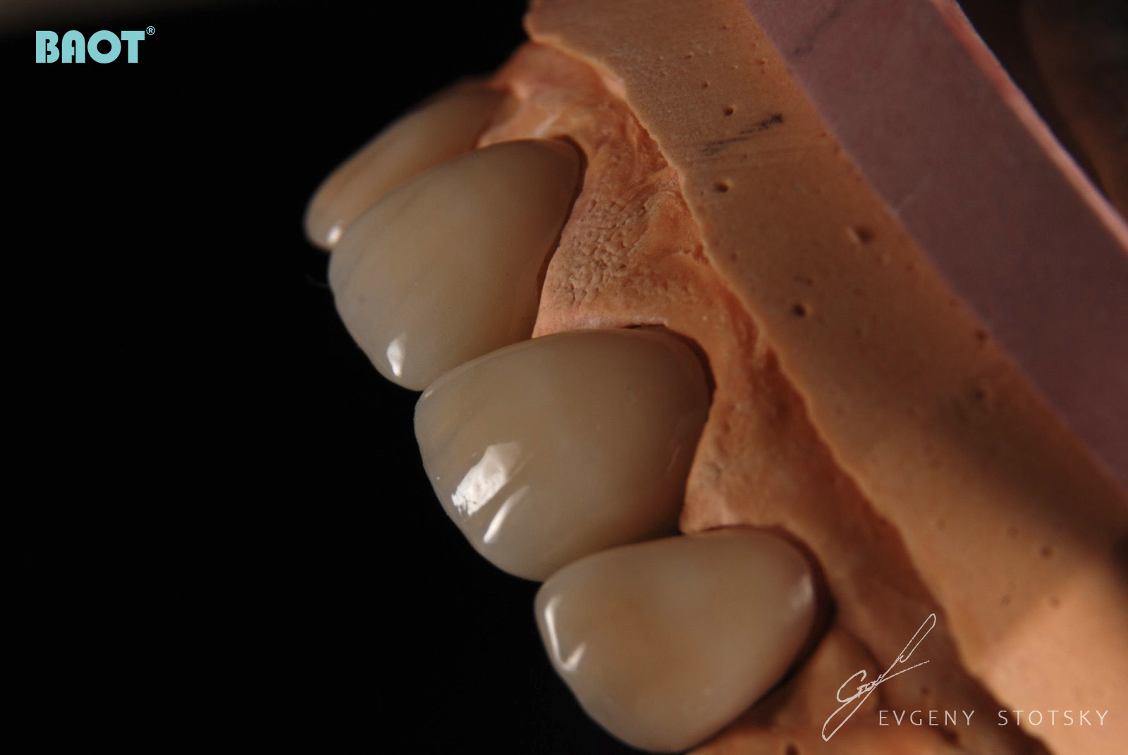 Poudre de matériau céramique dentaire pour la restauration