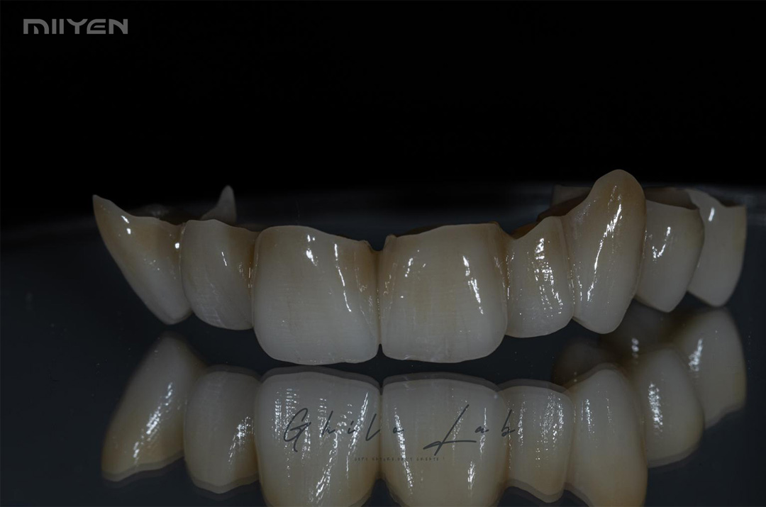 MIIYEN zircone 3D Pro pour dentaire