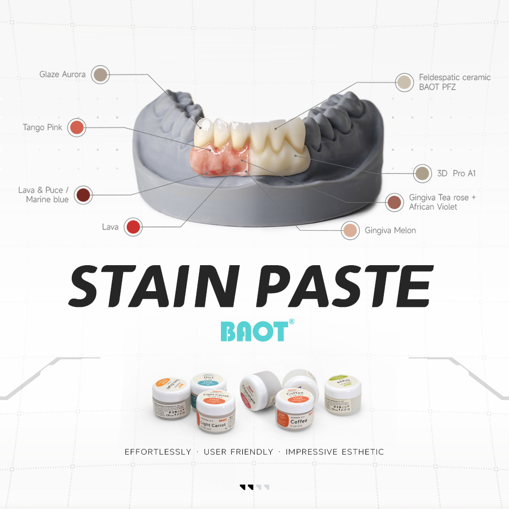 Kit de structure de glaçage dentaire pour laboratoire