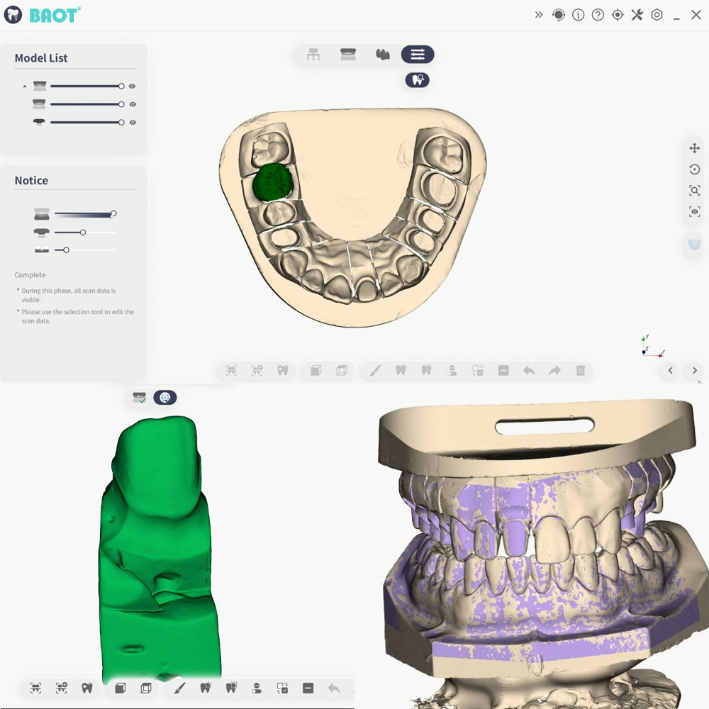 Scanner dentaire 3D, balayage de la mâchoire inférieure