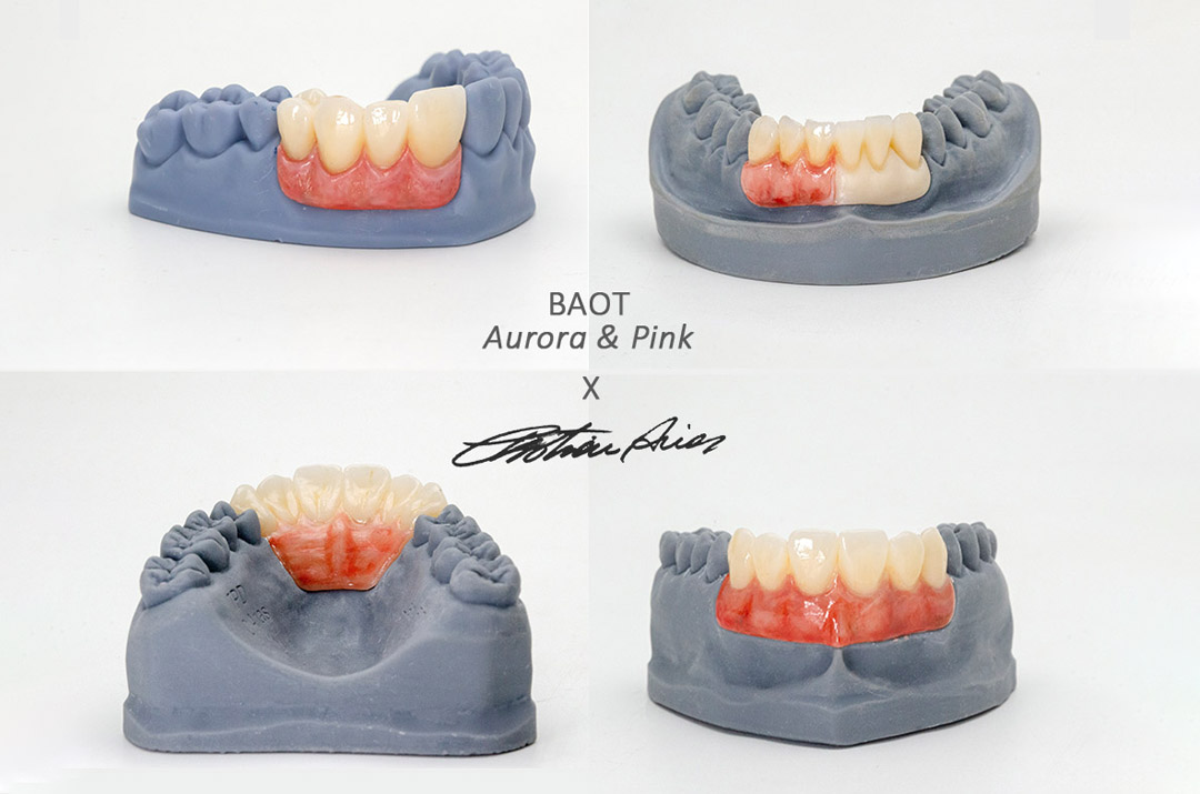 Conseils de glaçage pour teinture dentaire BAOT Aurora