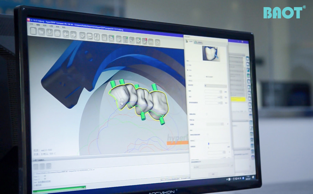 Le rôle des blocs de zircone dans l'avenir de la dentisterie numérique